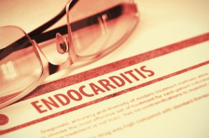 endocarditis, injection drug user, injection drugs, addiction diseases, drug infection, IV drug use, injection drug addiction